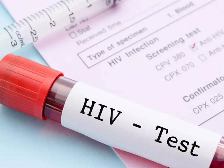 چگونه میتوانم بفهمم که hiv دارم